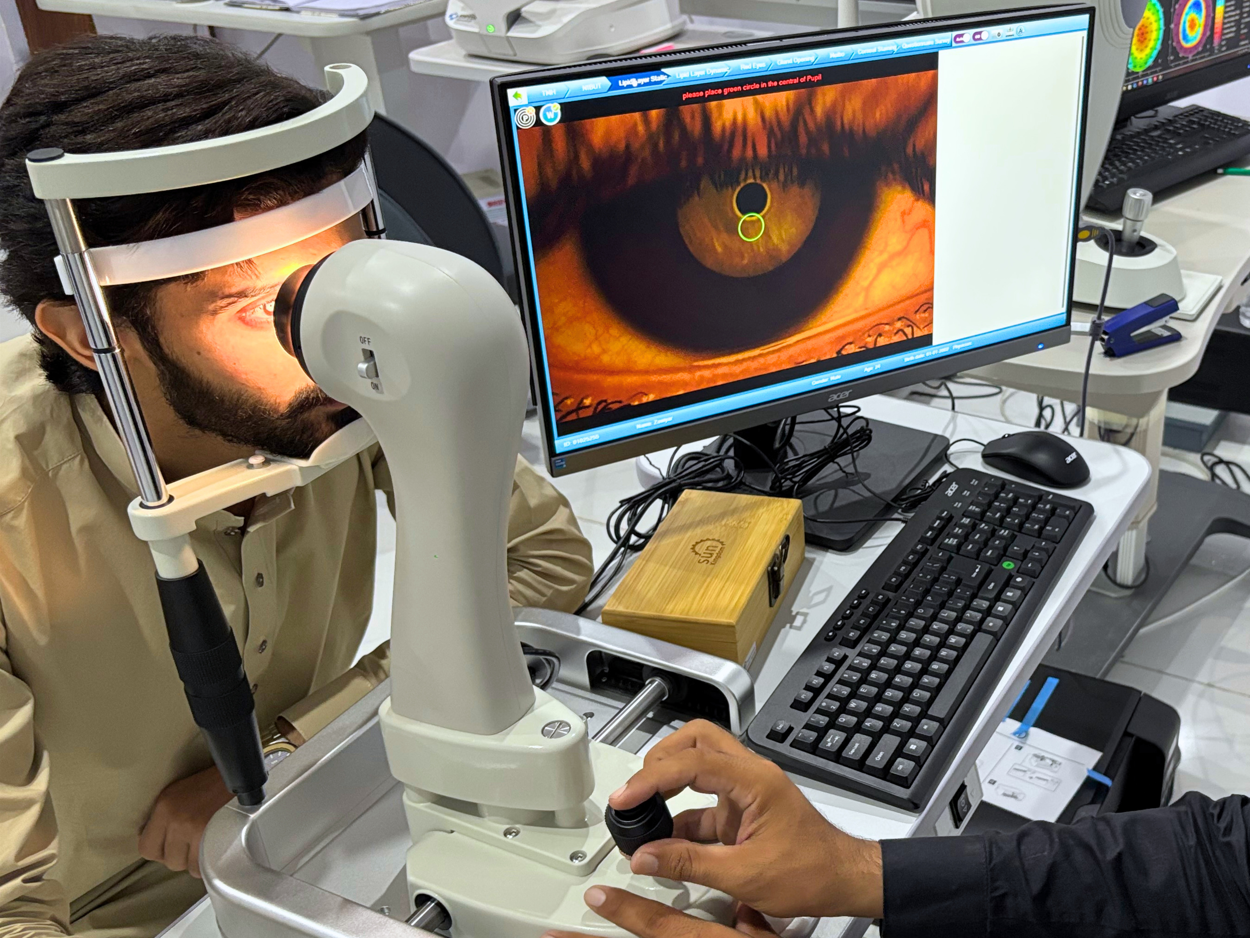 Tear Film Analyzer